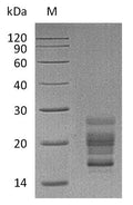 (Tris-Glycine gel) Discontinuous SDS-PAGE (reduced) with 5% enrichment gel and 15% separation gel.