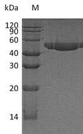 (Tris-Glycine gel) Discontinuous SDS-PAGE (reduced) with 5% enrichment gel and 15% separation gel.