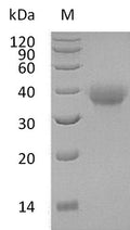 (Tris-Glycine gel) Discontinuous SDS-PAGE (reduced) with 5% enrichment gel and 15% separation gel.