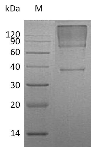 (Tris-Glycine gel) Discontinuous SDS-PAGE (reduced) with 5% enrichment gel and 15% separation gel.