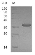 (Tris-Glycine gel) Discontinuous SDS-PAGE (reduced) with 5% enrichment gel and 15% separation gel.