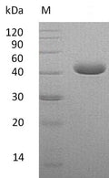 (Tris-Glycine gel) Discontinuous SDS-PAGE (reduced) with 5% enrichment gel and 15% separation gel.
