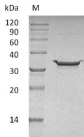(Tris-Glycine gel) Discontinuous SDS-PAGE (reduced) with 5% enrichment gel and 15% separation gel.