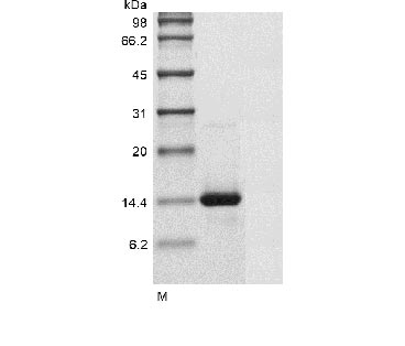 (Tris-Glycine gel) Discontinuous SDS-PAGE (reduced) with 5% enrichment gel and 15% separation gel.