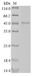 (Tris-Glycine gel) Discontinuous SDS-PAGE (reduced) with 5% enrichment gel and 15% separation gel.