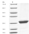 (Tris-Glycine gel) Discontinuous SDS-PAGE (reduced) with 5% enrichment gel and 15% separation gel.