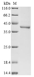 (Tris-Glycine gel) Discontinuous SDS-PAGE (reduced) with 5% enrichment gel and 15% separation gel.