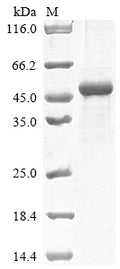 (Tris-Glycine gel) Discontinuous SDS-PAGE (reduced) with 5% enrichment gel and 15% separation gel.
