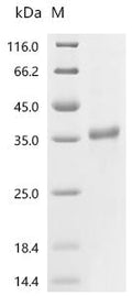 (Tris-Glycine gel) Discontinuous SDS-PAGE (reduced) with 5% enrichment gel and 15% separation gel.