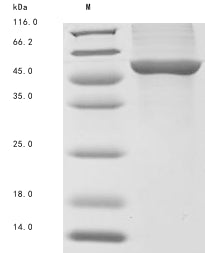 (Tris-Glycine gel) Discontinuous SDS-PAGE (reduced) with 5% enrichment gel and 15% separation gel.