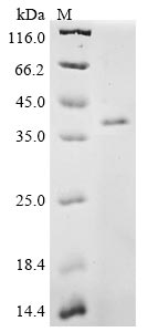 (Tris-Glycine gel) Discontinuous SDS-PAGE (reduced) with 5% enrichment gel and 15% separation gel.