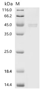 (Tris-Glycine gel) Discontinuous SDS-PAGE (reduced) with 5% enrichment gel and 15% separation gel.