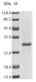 (Tris-Glycine gel) Discontinuous SDS-PAGE (reduced) with 5% enrichment gel and 15% separation gel.