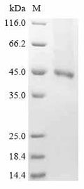 (Tris-Glycine gel) Discontinuous SDS-PAGE (reduced) with 5% enrichment gel and 15% separation gel.