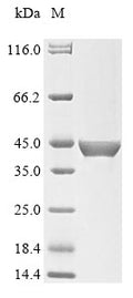 (Tris-Glycine gel) Discontinuous SDS-PAGE (reduced) with 5% enrichment gel and 15% separation gel.