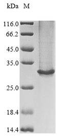 (Tris-Glycine gel) Discontinuous SDS-PAGE (reduced) with 5% enrichment gel and 15% separation gel.