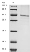 (Tris-Glycine gel) Discontinuous SDS-PAGE (reduced) with 5% enrichment gel and 15% separation gel.