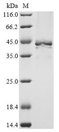 (Tris-Glycine gel) Discontinuous SDS-PAGE (reduced) with 5% enrichment gel and 15% separation gel.