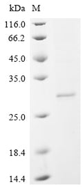 (Tris-Glycine gel) Discontinuous SDS-PAGE (reduced) with 5% enrichment gel and 15% separation gel.