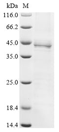 (Tris-Glycine gel) Discontinuous SDS-PAGE (reduced) with 5% enrichment gel and 15% separation gel.