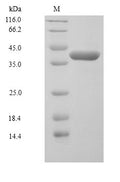 (Tris-Glycine gel) Discontinuous SDS-PAGE (reduced) with 5% enrichment gel and 15% separation gel.