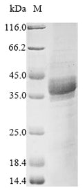(Tris-Glycine gel) Discontinuous SDS-PAGE (reduced) with 5% enrichment gel and 15% separation gel.