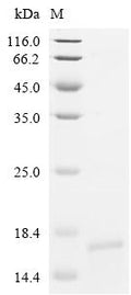 Recombinant Human Homeobox protein Nkx-3.2 (Nkx3-2), partial – Figure 1 of 1