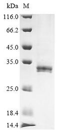 (Tris-Glycine gel) Discontinuous SDS-PAGE (reduced) with 5% enrichment gel and 15% separation gel.