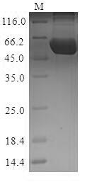 (Tris-Glycine gel) Discontinuous SDS-PAGE (reduced) with 5% enrichment gel and 15% separation gel.