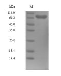 (Tris-Glycine gel) Discontinuous SDS-PAGE (reduced) with 5% enrichment gel and 15% separation gel.