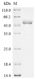 (Tris-Glycine gel) Discontinuous SDS-PAGE (reduced) with 5% enrichment gel and 15% separation gel.