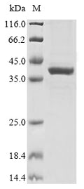 (Tris-Glycine gel) Discontinuous SDS-PAGE (reduced) with 5% enrichment gel and 15% separation gel.