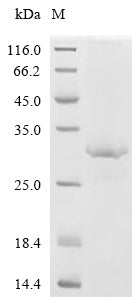 (Tris-Glycine gel) Discontinuous SDS-PAGE (reduced) with 5% enrichment gel and 15% separation gel.
