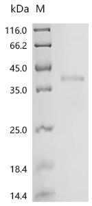 (Tris-Glycine gel) Discontinuous SDS-PAGE (reduced) with 5% enrichment gel and 15% separation gel.