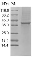 (Tris-Glycine gel) Discontinuous SDS-PAGE (reduced) with 5% enrichment gel and 15% separation gel.