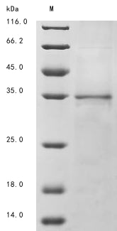 (Tris-Glycine gel) Discontinuous SDS-PAGE (reduced) with 5% enrichment gel and 15% separation gel.