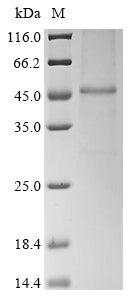 (Tris-Glycine gel) Discontinuous SDS-PAGE (reduced) with 5% enrichment gel and 15% separation gel.