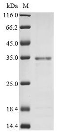 (Tris-Glycine gel) Discontinuous SDS-PAGE (reduced) with 5% enrichment gel and 15% separation gel.