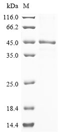 (Tris-Glycine gel) Discontinuous SDS-PAGE (reduced) with 5% enrichment gel and 15% separation gel.