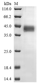 (Tris-Glycine gel) Discontinuous SDS-PAGE (reduced) with 5% enrichment gel and 15% separation gel.