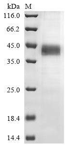 (Tris-Glycine gel) Discontinuous SDS-PAGE (reduced) with 5% enrichment gel and 15% separation gel.