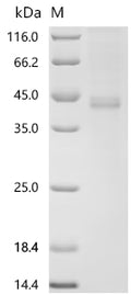 (Tris-Glycine gel) Discontinuous SDS-PAGE (reduced) with 5% enrichment gel and 15% separation gel.
