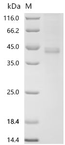 (Tris-Glycine gel) Discontinuous SDS-PAGE (reduced) with 5% enrichment gel and 15% separation gel.