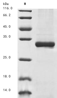(Tris-Glycine gel) Discontinuous SDS-PAGE (reduced) with 5% enrichment gel and 15% separation gel.