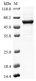(Tris-Glycine gel) Discontinuous SDS-PAGE (reduced) with 5% enrichment gel and 15% separation gel.