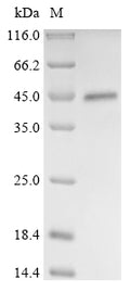 (Tris-Glycine gel) Discontinuous SDS-PAGE (reduced) with 5% enrichment gel and 15% separation gel.