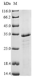 (Tris-Glycine gel) Discontinuous SDS-PAGE (reduced) with 5% enrichment gel and 15% separation gel.