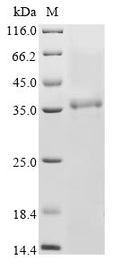 (Tris-Glycine gel) Discontinuous SDS-PAGE (reduced) with 5% enrichment gel and 15% separation gel.