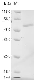 (Tris-Glycine gel) Discontinuous SDS-PAGE (reduced) with 5% enrichment gel and 15% separation gel.
