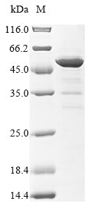 (Tris-Glycine gel) Discontinuous SDS-PAGE (reduced) with 5% enrichment gel and 15% separation gel.